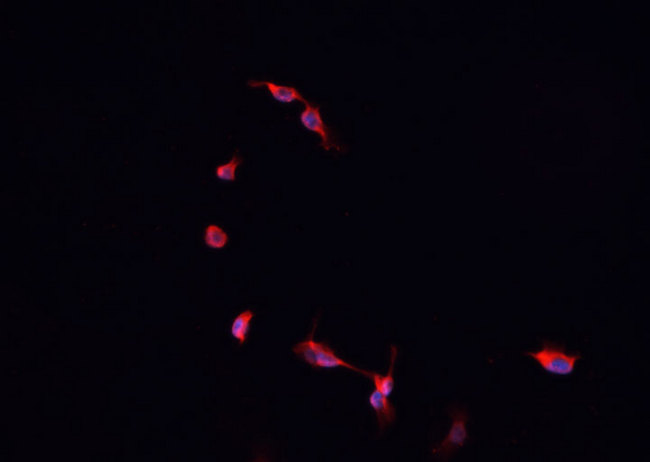CREBBP / CREB Binding Protein Antibody - Staining HeLa cells by IF/ICC. The samples were fixed with PFA and permeabilized in 0.1% Triton X-100, then blocked in 10% serum for 45 min at 25°C. The primary antibody was diluted at 1:200 and incubated with the sample for 1 hour at 37°C. An Alexa Fluor 594 conjugated goat anti-rabbit IgG (H+L) antibody, diluted at 1/600, was used as secondary antibody.