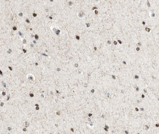 CREBBP / CREB Binding Protein Antibody - 1:100 staining human brain tissue by IHC-P. The tissue was formaldehyde fixed and a heat mediated antigen retrieval step in citrate buffer was performed. The tissue was then blocked and incubated with the antibody for 1.5 hours at 22°C. An HRP conjugated goat anti-rabbit antibody was used as the secondary.