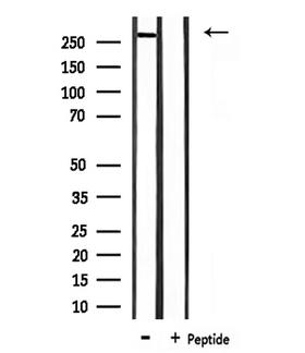 CREBBP / CREB Binding Protein Antibody - Western blot analysis of extracts of mouse lung using CBP antibody. The lane on the right is treated with the antigen-specific peptide.
