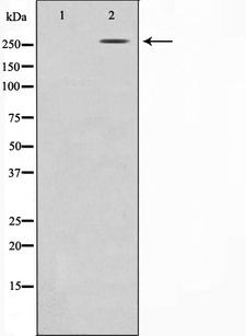 CREBBP / CREB Binding Protein Antibody - Western blot analysis on HeLa cell lysates using CBP antibody. The lane on the left is treated with the antigen-specific peptide.