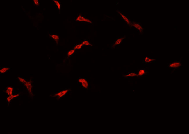 CREBBP / CREB Binding Protein Antibody - Staining A549 cells by IF/ICC. The samples were fixed with PFA and permeabilized in 0.1% Triton X-100, then blocked in 10% serum for 45 min at 25°C. The primary antibody was diluted at 1:200 and incubated with the sample for 1 hour at 37°C. An Alexa Fluor 594 conjugated goat anti-rabbit IgG (H+L) antibody, diluted at 1/600, was used as secondary antibody.