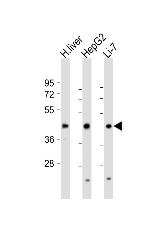 CREBH / CREB3L3 Antibody - All lanes: Anti-CREB3L3 Antibody (Center) at 1:1000-1:2000 dilution. Lane 1: human liver lysate. Lane 2: HepG2 whole cell lysate. Lane 3: Li-7 whole cell lysate Lysates/proteins at 20 ug per lane. Secondary Goat Anti-Rabbit IgG, (H+L), Peroxidase conjugated at 1:10000 dilution. Predicted band size: 49 kDa. Blocking/Dilution buffer: 5% NFDM/TBST.