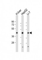 CREBH / CREB3L3 Antibody - All lanes: Anti-CREB3L3 Antibody (Center) at 1:1000-1:2000 dilution. Lane 1: human liver lysate. Lane 2: HepG2 whole cell lysate. Lane 3: Li-7 whole cell lysate Lysates/proteins at 20 ug per lane. Secondary Goat Anti-Rabbit IgG, (H+L), Peroxidase conjugated at 1:10000 dilution. Predicted band size: 49 kDa. Blocking/Dilution buffer: 5% NFDM/TBST.