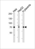 CREBL1 / ATF6B Antibody - Western blot of lysates from HeLa, HepG2 cell line and human placenta tissue lysate (from left to right), using CREBL1Antibody. Antibody was diluted at 1:1000 at each lane. A goat anti-rabbit IgG H&L (HRP) at 1:5000 dilution was used as the secondary antibody. Lysates at 35ug per lane.