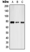 CREBL1 / ATF6B Antibody - Western blot analysis of ATF6B expression in HepG2 (A); mouse liver (B); rat liver (C) whole cell lysates.