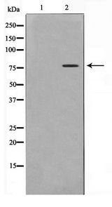 CREBL1 / ATF6B Antibody - Western blot of COLO205 cell lysate using ATF6B Antibody