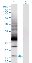 CREBL2 Antibody - Western Blot analysis of CREBL2 expression in transfected 293T cell line by CREBL2 monoclonal antibody (M04), clone 1C1.Lane 1: CREBL2 transfected lysate (Predicted MW: 13.8 KDa).Lane 2: Non-transfected lysate.