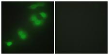 CREBZF / Zhangfei Antibody - Immunofluorescence analysis of HepG2 cells, using CREBZF Antibody. The picture on the right is blocked with the synthesized peptide.