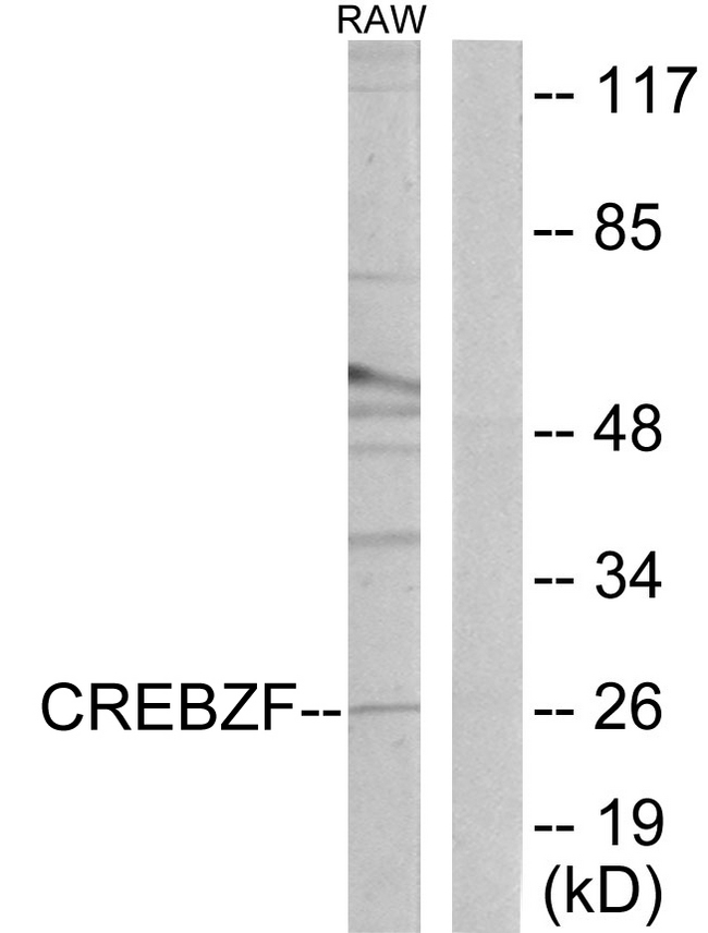 CREBZF / Zhangfei Antibody - Western blot analysis of lysates from RAW264.7 cells, using CREBZF Antibody. The lane on the right is blocked with the synthesized peptide.