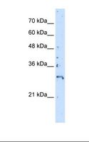 CREBZF / Zhangfei Antibody - CCRF-CEM cell lysate. Antibody concentration: 5.0 ug/ml. Gel concentration: 12%.  This image was taken for the unconjugated form of this product. Other forms have not been tested.