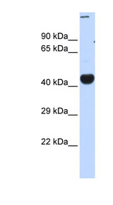 CREBZF / Zhangfei Antibody - CREBZF antibody Western blot of Fetal Muscle lysate. This image was taken for the unconjugated form of this product. Other forms have not been tested.
