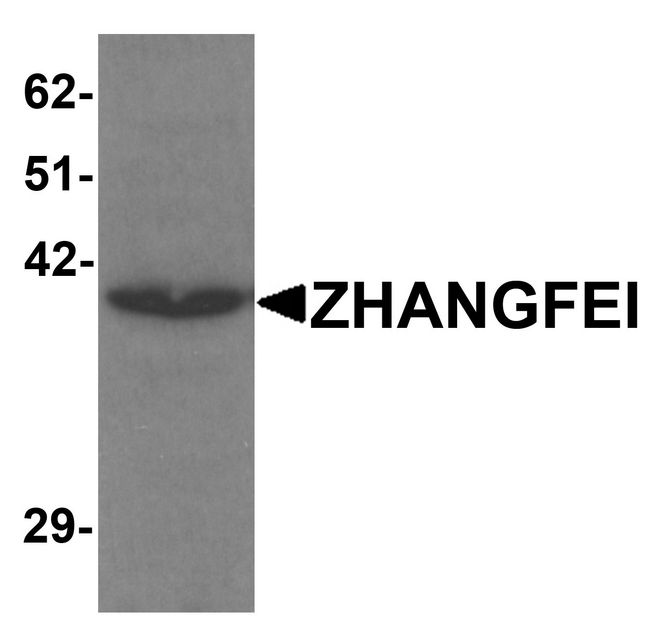 CREBZF / Zhangfei Antibody - Western blot analysis of ZHANGFEI in K562 cell lysate with ZHANGFEI antibody at 1 ug/ml.