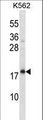 CREG / CREG1 Antibody - CREG1 Antibody western blot of K562 cell line lysates (35 ug/lane). The CREG1 antibody detected the CREG1 protein (arrow).