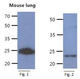 CREG / CREG1 Antibody - Fig. 1: The tissue extract of mouse lung (40ug) were resolved by SDS-PAGE, transferred to PVDF membrane and probed with anti-human CREG1 antibody (1:1000). Proteins were visualized using a goat anti-mouse secondary antibody conjugated to HRP and an ECL detection system. Fig. 2: The Recombinant Human CREG1 (50ng) protein were resolved by SDS-PAGE, transferred to PVDF membrane and probed with anti-human CREG1 antibody (1:1000). Proteins were visualized using a goat anti-mouse secondary antibody conjugated to HRP and an ECL detection system.