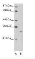 CREG / CREG1 Antibody - A: Marker, B: Transfected 293T Cell Lysate.  This image was taken for the unconjugated form of this product. Other forms have not been tested.