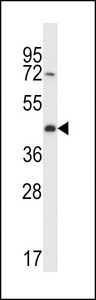 CREG2 Antibody - CREG2 Antibody western blot of A2058 cell line lysates (35 ug/lane). The CREG2 antibody detected the CREG2 protein (arrow).