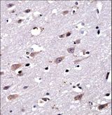 CREG2 Antibody - CREG2 Antibody immunohistochemistry of formalin-fixed and paraffin-embedded human brain tissue followed by peroxidase-conjugated secondary antibody and DAB staining.