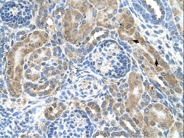 CRELD1 Antibody - CRELD1 antibody CRELD1(cysteine-rich with EGF-like domains 1) Antibody was used in IHC to stain formalin-fixed, paraffin-embedded human kidney.  This image was taken for the unconjugated form of this product. Other forms have not been tested.