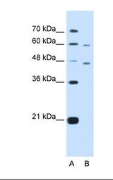 CRELD1 Antibody - Lane A: Marker. Lane B: HepG2 cell lysate. Antibody concentration: 5.0 ug/ml. Gel concentration: 12%.  This image was taken for the unconjugated form of this product. Other forms have not been tested.