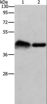 CRELD1 Antibody - Western blot analysis of Mouse bladder tissue and 293T cell, using CRELD1 Polyclonal Antibody at dilution of 1:930.