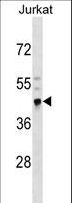 CRELD2 Antibody - CRELD2 Antibody western blot of Jurkat cell line lysates (35 ug/lane). The CRELD2 antibody detected the CRELD2 protein (arrow).