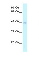 CRELD2 Antibody - CRELD2 antibody Western blot of Placenta lysate. Antibody concentration 1 ug/ml.  This image was taken for the unconjugated form of this product. Other forms have not been tested.