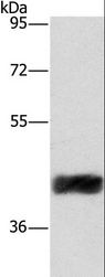 CRELD2 Antibody - Western blot analysis of Human fetal liver tissue, using CRELD2 Polyclonal Antibody at dilution of 1:421.