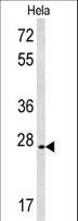 CREM / ICER Antibody - Western blot of CREM Antibody in HeLa cell line lysates (35 ug/lane). CREM (arrow) was detected using the purified antibody.