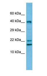 CREM / ICER Antibody - CREM / ICER antibody Western Blot of Rat Thymus.  This image was taken for the unconjugated form of this product. Other forms have not been tested.