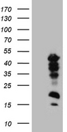 CREM / ICER Antibody - HEK293T cells were transfected with the pCMV6-ENTRY control. (Left lane) or pCMV6-ENTRY CREM. (Right lane) cDNA for 48 hrs and lysed