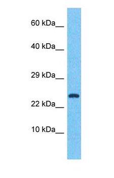 CREM / ICER Antibody - Western blot of CREM Antibody with human Fetal Kidney lysate.  This image was taken for the unconjugated form of this product. Other forms have not been tested.