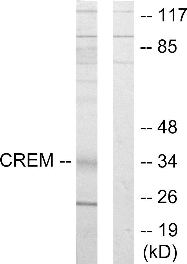 CREM / ICER Antibody - Western blot analysis of extracts from K562 cells, using CREM antibody.