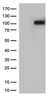 CRF2-12 / IL28RA Antibody - HEK293T cells were transfected with the pCMV6-ENTRY control. (Left lane) or pCMV6-ENTRY IFNLR1. (Right lane) cDNA for 48 hrs and lysed. Equivalent amounts of cell lysates. (5 ug per lane) were separated by SDS-PAGE and immunoblotted with anti-IFNLR1. (1:500)