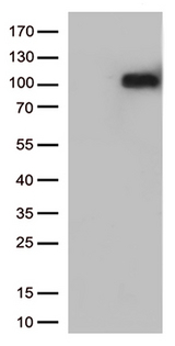 CRF2-12 / IL28RA Antibody - HEK293T cells were transfected with the pCMV6-ENTRY control. (Left lane) or pCMV6-ENTRY IFNLR1. (Right lane) cDNA for 48 hrs and lysed. Equivalent amounts of cell lysates. (5 ug per lane) were separated by SDS-PAGE and immunoblotted with anti-IFNLR1. (1:500)