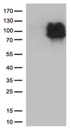 CRF2-12 / IL28RA Antibody - HEK293T cells were transfected with the pCMV6-ENTRY control. (Left lane) or pCMV6-ENTRY IFNLR1. (Right lane) cDNA for 48 hrs and lysed. Equivalent amounts of cell lysates. (5 ug per lane) were separated by SDS-PAGE and immunoblotted with anti-IFNLR1. (1:500)