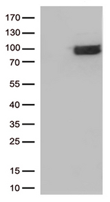 CRF2-12 / IL28RA Antibody - HEK293T cells were transfected with the pCMV6-ENTRY control. (Left lane) or pCMV6-ENTRY IFNLR1. (Right lane) cDNA for 48 hrs and lysed. Equivalent amounts of cell lysates. (5 ug per lane) were separated by SDS-PAGE and immunoblotted with anti-IFNLR1. (1:500)