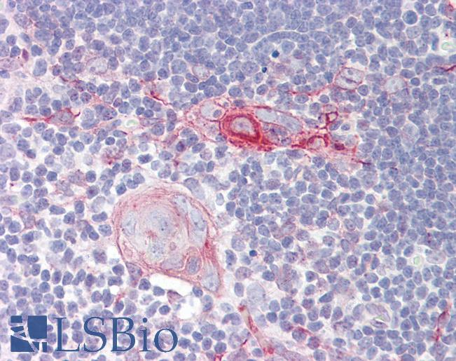 CRF2-12 / IL28RA Antibody - Anti-CRF2-12 / IL28RA antibody IHC of human thymus. Immunohistochemistry of formalin-fixed, paraffin-embedded tissue after heat-induced antigen retrieval. Antibody dilution 2.5-5 ug/ml. This image was taken for the unconjugated form of this product. Other forms have not been tested.