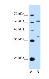 CRF2-12 / IL28RA Antibody - Lane A: Marker. Lane B: HepG2 cell lysate. Antibody concentration: 1.0 ug/ml. Gel concentration: 12%.  This image was taken for the unconjugated form of this product. Other forms have not been tested.