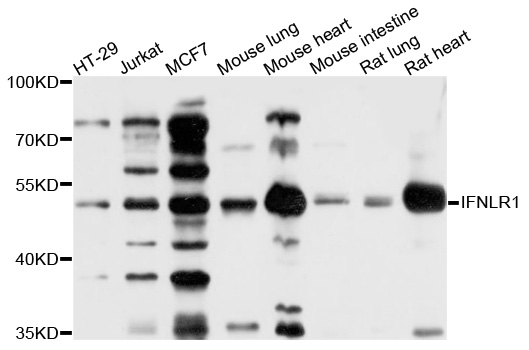 CRF2-12 / IL28RA Antibody - Western blot analysis of extracts of various cell lines, using IFNLR1 antibody at 1:1000 dilution. The secondary antibody used was an HRP Goat Anti-Rabbit IgG (H+L) at 1:10000 dilution. Lysates were loaded 25ug per lane and 3% nonfat dry milk in TBST was used for blocking. An ECL Kit was used for detection and the exposure time was 10s.