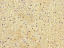 CRF2-12 / IL28RA Antibody - Immunohistochemistry of paraffin-embedded human adrenal gland tissue at dilution 1:100