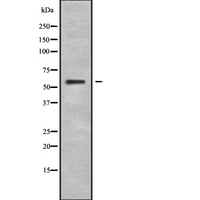 CRF2-12 / IL28RA Antibody - Western blot analysis IL28RA using HeLa whole cells lysates