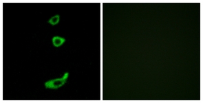 CRFR1 / CRHR1 Antibody - Immunofluorescence of MCF7 cells, using CRHR1 Antibody. The picture on the right is treated with the synthesized peptide.