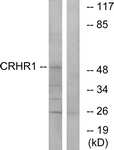 CRFR1 / CRHR1 Antibody - Western blot of extracts from HT-29/LOVO cells, using CRHR1 Antibody. The lane on the right is treated with the synthesized peptide.