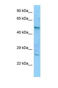 CRFR1 / CRHR1 Antibody - CRHR1 / CRF1 antibody Western blot of A549 Cell lysate. Antibody concentration 1 ug/ml.  This image was taken for the unconjugated form of this product. Other forms have not been tested.