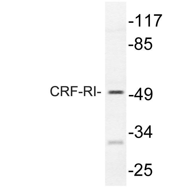 CRFR1 / CRHR1 Antibody - Western blot of CRF-RI (H177) pAb in extracts from HT-29 cells.