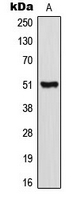 CRFR1 / CRHR1 Antibody - Western blot analysis of CRHR1 expression in HeLa (A) whole cell lysates.