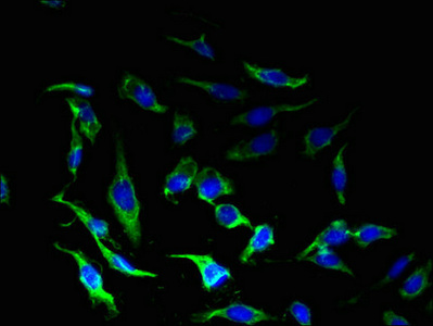 CRFR1 / CRHR1 Antibody - Immunofluorescent analysis of Hela cells using CRHR1 Antibody at dilution of 1:100 and Alexa Fluor 488-congugated AffiniPure Goat Anti-Rabbit IgG(H+L)