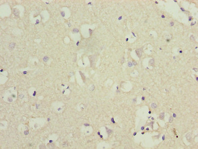 CRFR1 / CRHR1 Antibody - Immunohistochemistry of paraffin-embedded human brain tissue using CRHR1 Antibody at dilution of 1:100