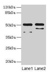 CRFR1 / CRHR1 Antibody - Western blot All lanes: CRHR1 antibody at 16µg/ml Lane 1: Hela whole cell lysate Lane 2: MCF-7 whole cell lysate Lane 3: Mouse brain tissue Lane 4: Mouse liver tissue Lane 5: HL60 whole cell lysate Lane 6: K562 whole cell lysate Secondary Goat polyclonal to rabbit IgG at 1/10000 dilution Predicted band size: 51, 48, 44, 47, 29 kDa Observed band size: 51 kDa