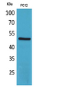 CRFR1 / CRHR1 Antibody - Western Blot analysis of extracts from PC12 cells using CRHR1 Antibody.